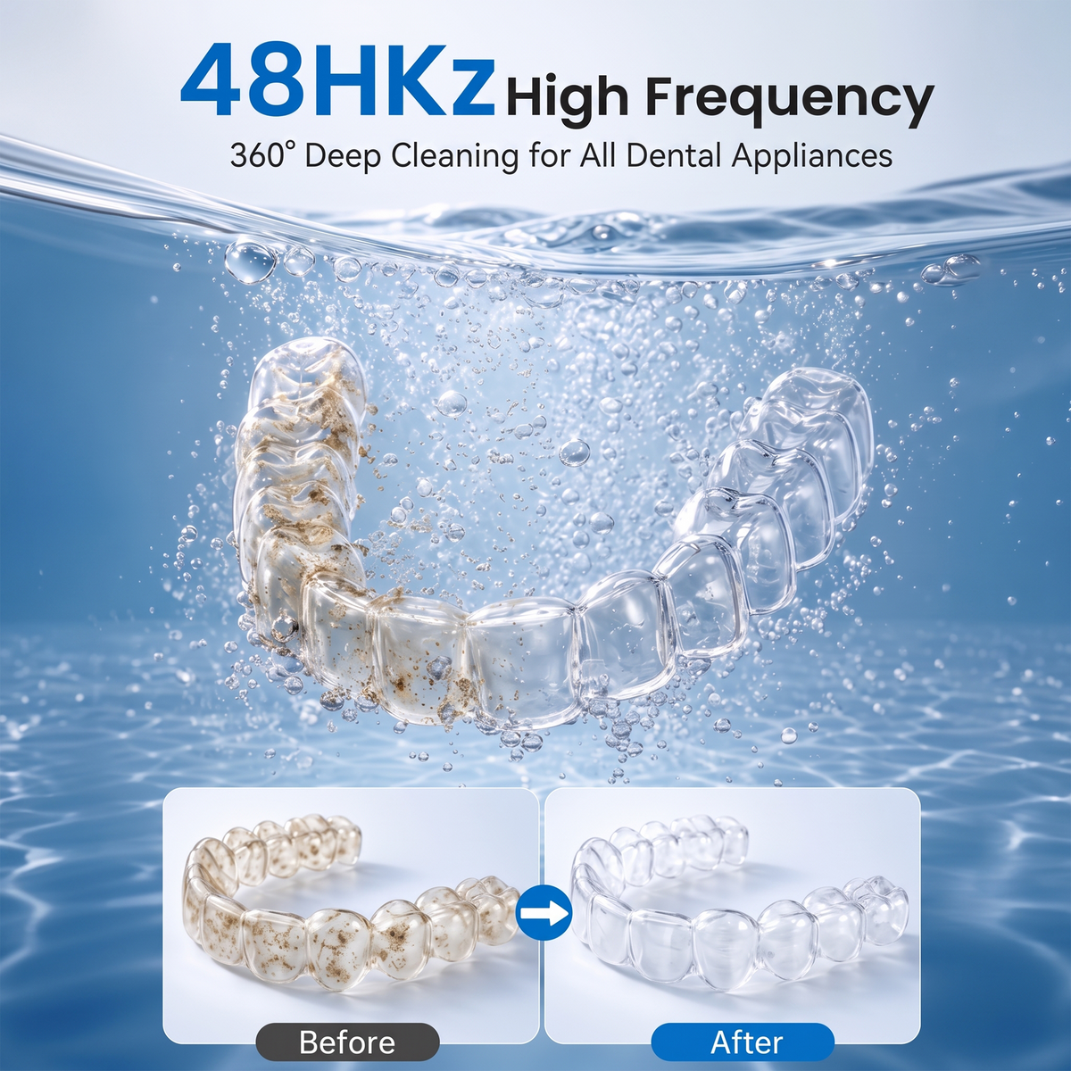 KUNPHY 48kHz Ultrasonic Dental Cleaner | For Retainers, Aligners & Electric Toothbrush Heads