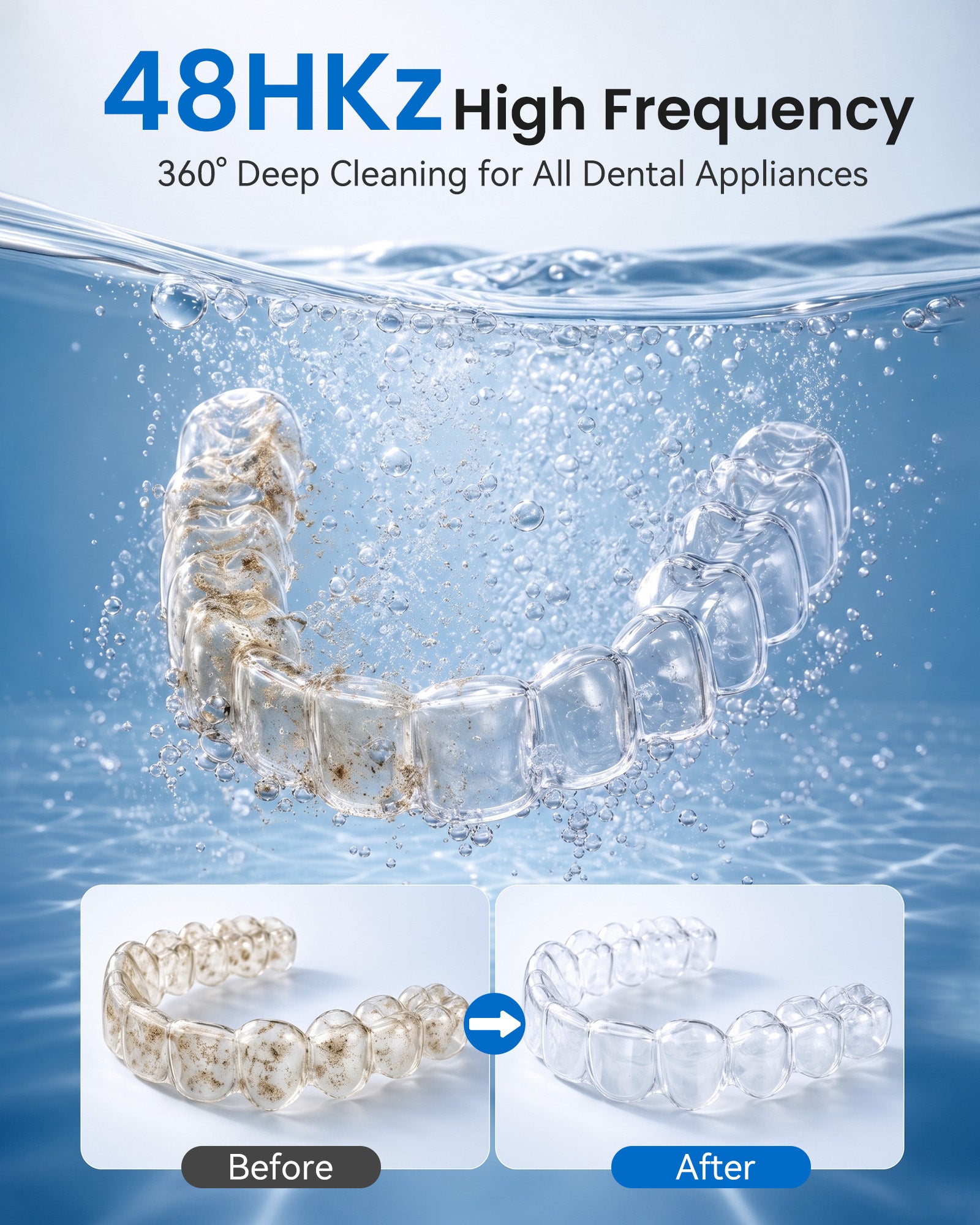 KUNPHY 48kHz Ultrasonic Dental Cleaner | For Retainers, Aligners & Electric Toothbrush Heads