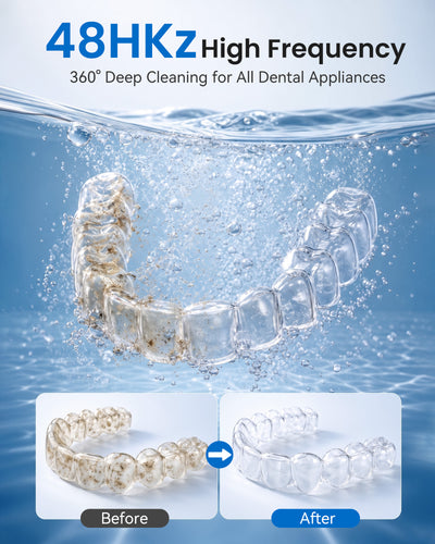 KUNPHY 48kHz Ultrasonic Dental Cleaner | For Retainers, Aligners & Electric Toothbrush Heads